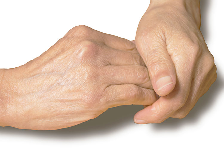 リウマチ科とは